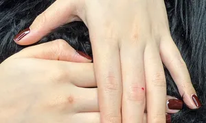 Rủi ro khi xăm nốt ruồi son 'đổi vận' năm mới
